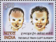 [The Smile Train - Cleft Surgery, type DAU]