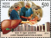 [Liver Transplantation, type DIS]