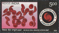 [Sickle Cell Eradication, type FJQ]